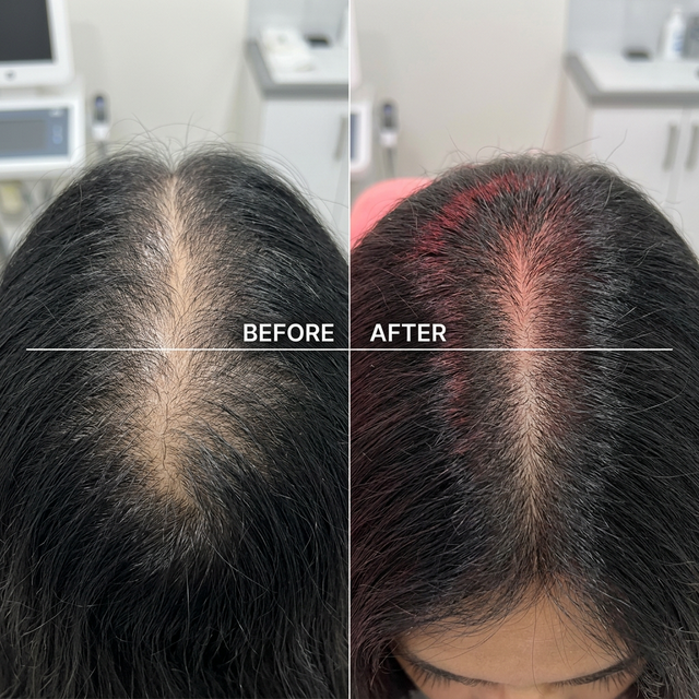 How Can I Make My Hair Thicker? Expert Dermatologist Answers