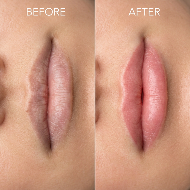 Best Hair and Skin Clinic in Gurgaon Result