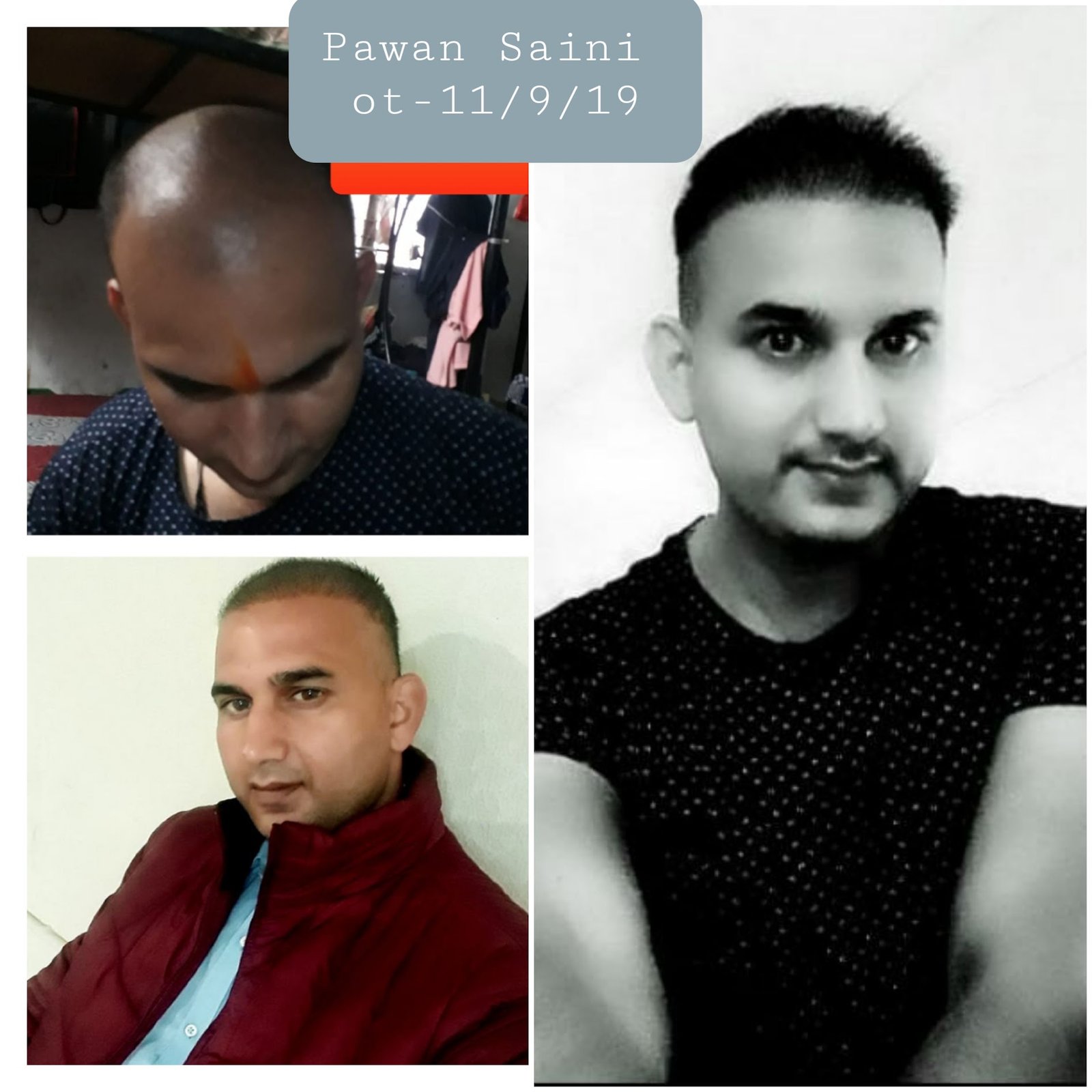 DenceSpot Patient Result Transformation