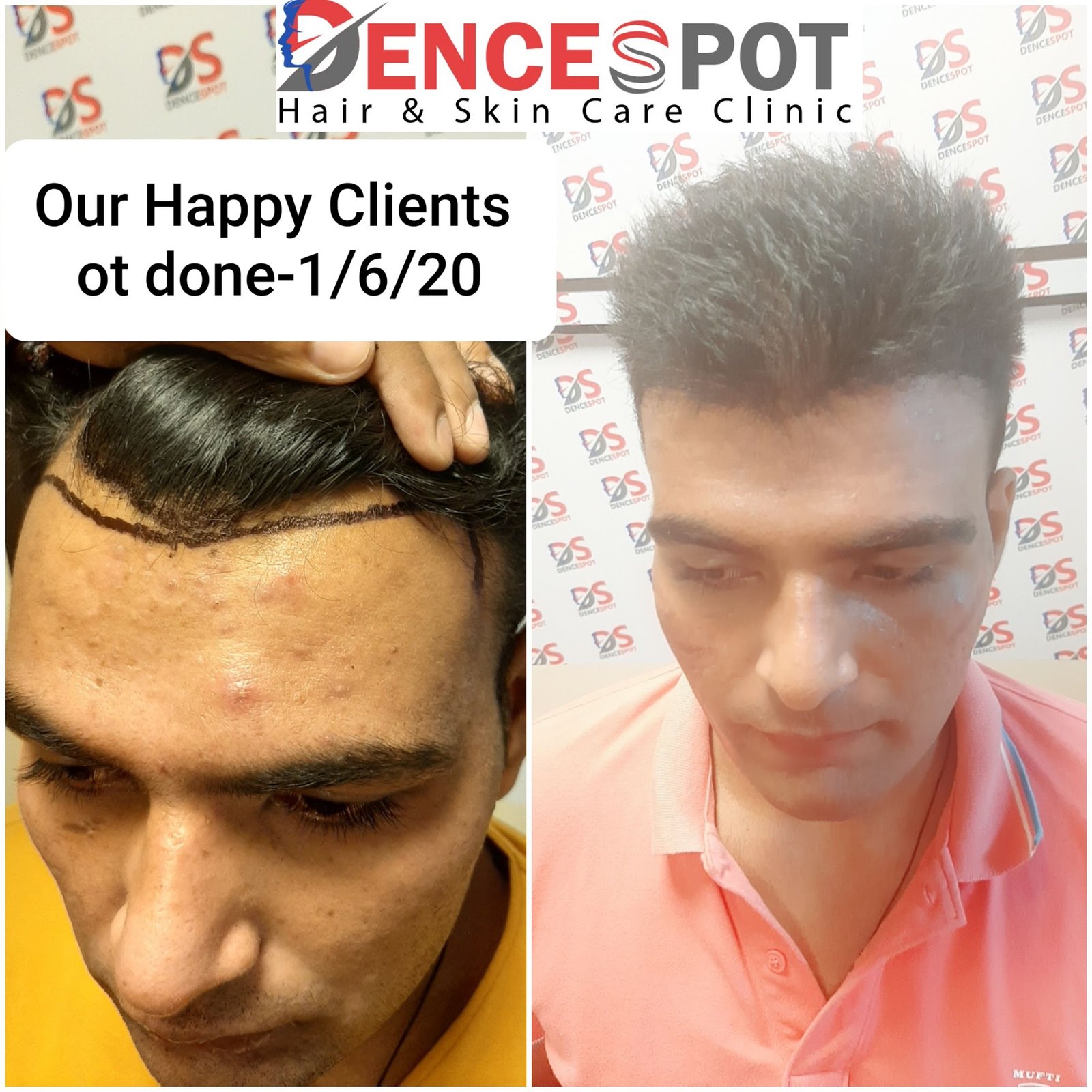 DenceSpot Patient Result Transformation