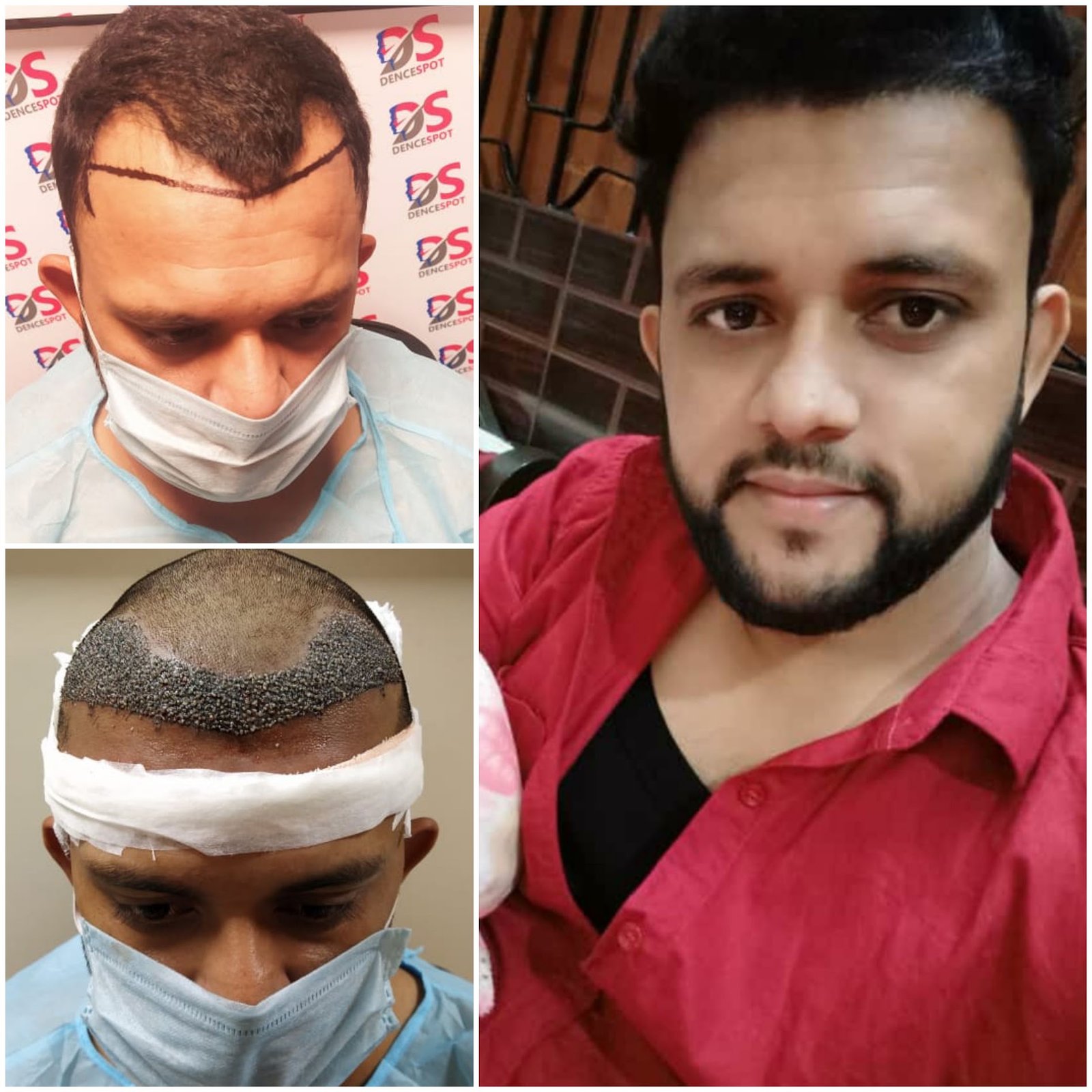 DenceSpot Patient Result Transformation