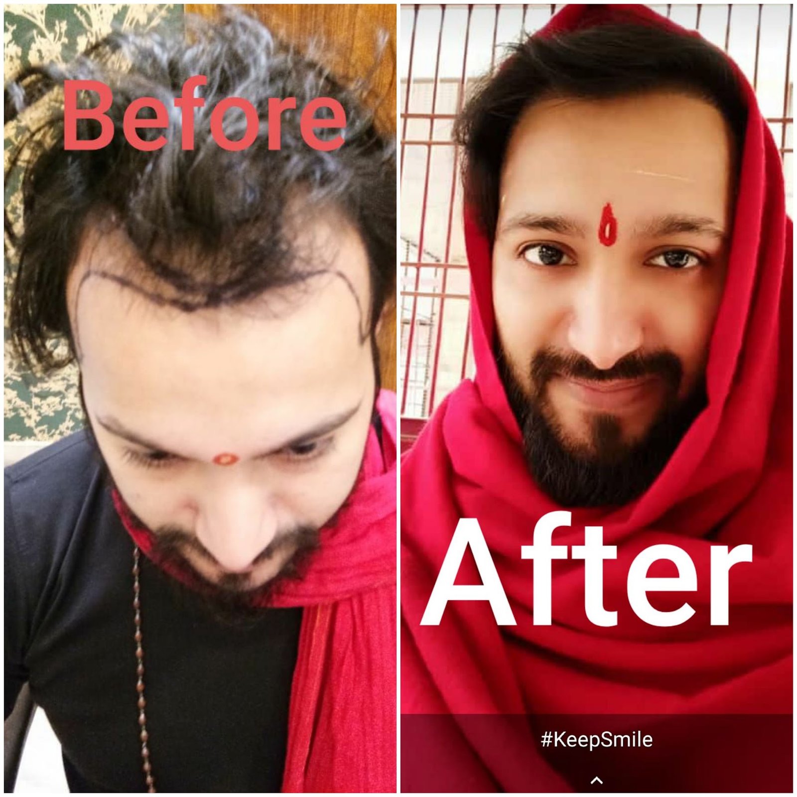 DenceSpot Patient Result Transformation