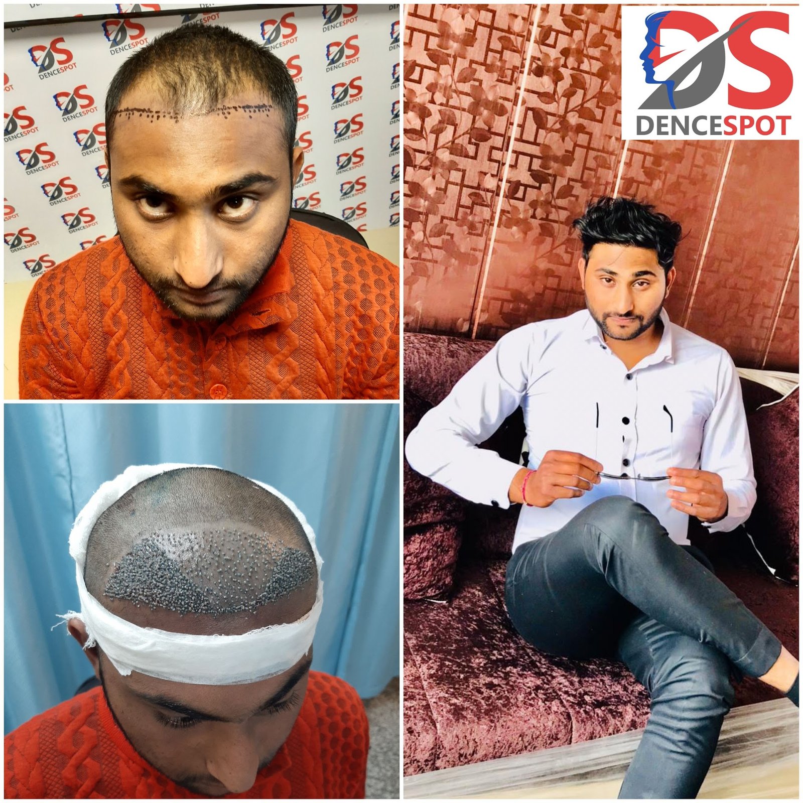 DenceSpot Patient Result Transformation