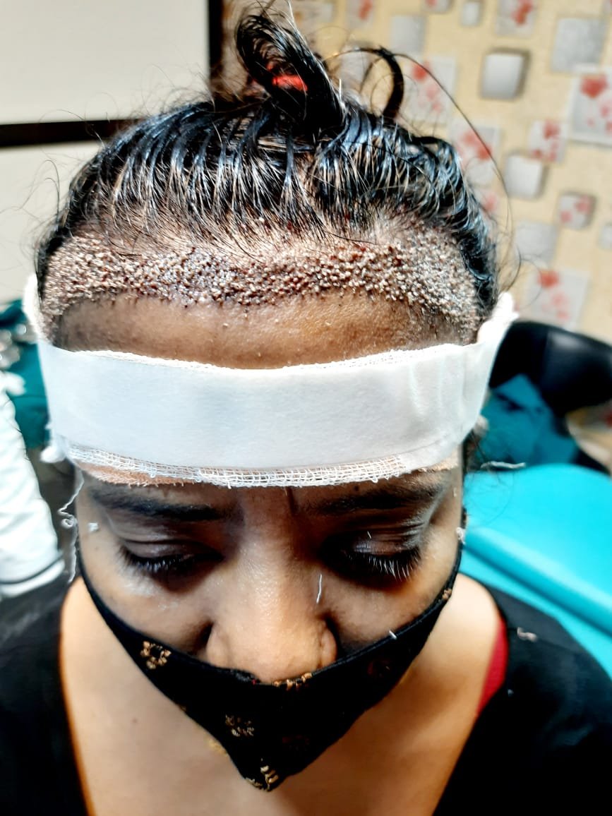 DenceSpot Patient Result Transformation