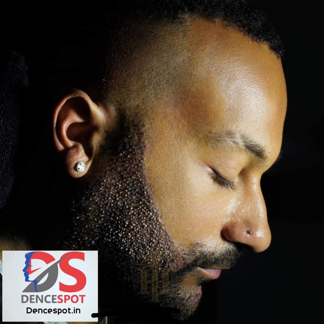 DenceSpot Patient Result Transformation