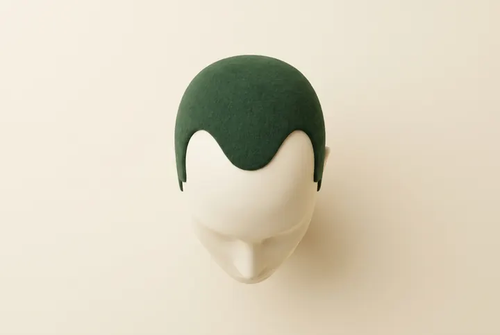 AI-generated diagram of a receding hairline seen from above